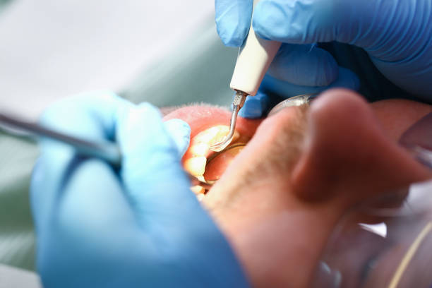  Chatmoss, VA Emergency Dentist Pros