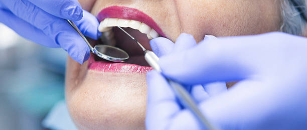 Best Emergency Wisdom Teeth Removal in Chatmoss, VA